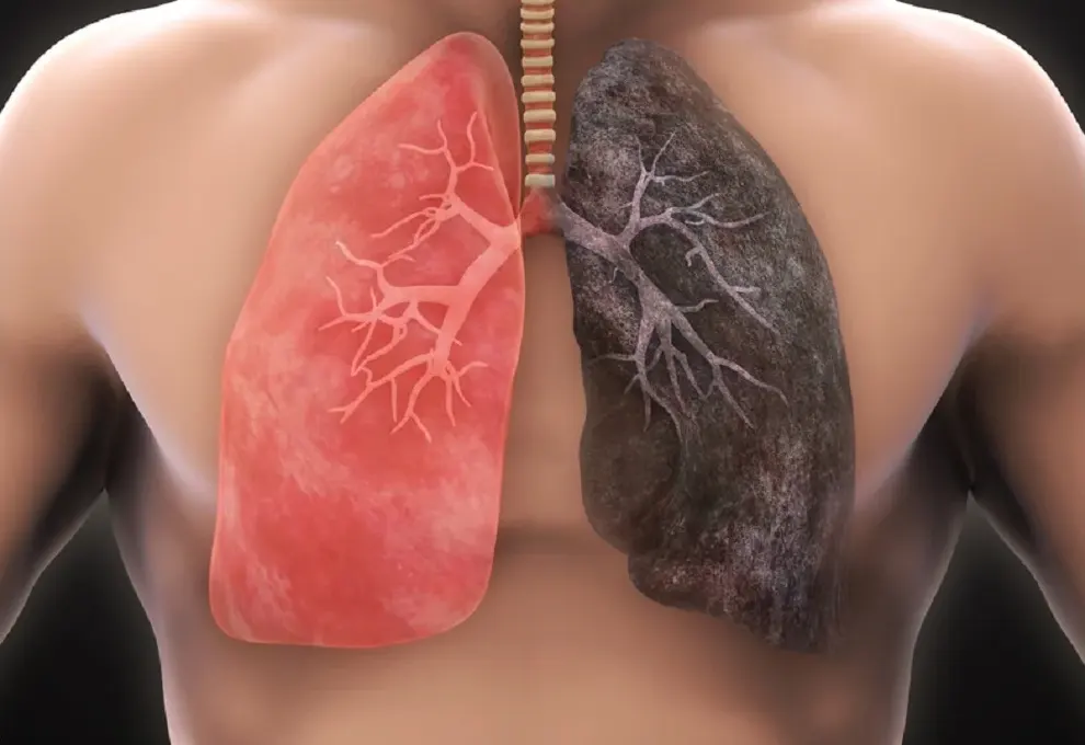 Lungs affected by secondhand smoke, emphasizing the risk of respiratory diseases